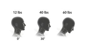 Understanding the physics of head weight is the first step in learning how to fix tech neck.